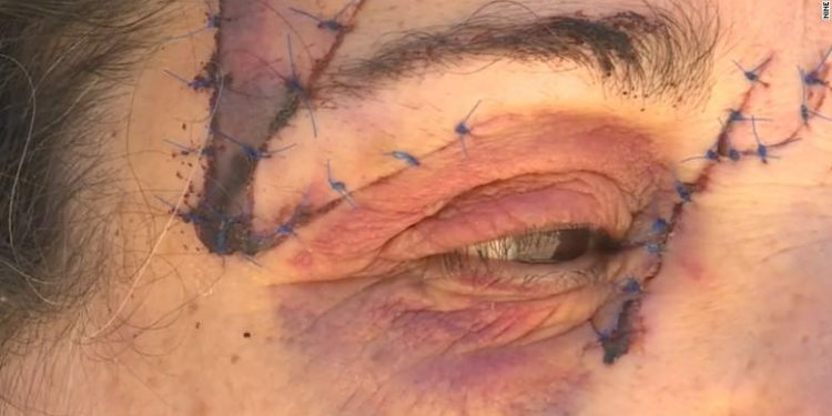 Una mujer que paseaba a su perro en Australia fue atacada por un gran canguro y quedó gravemente herida