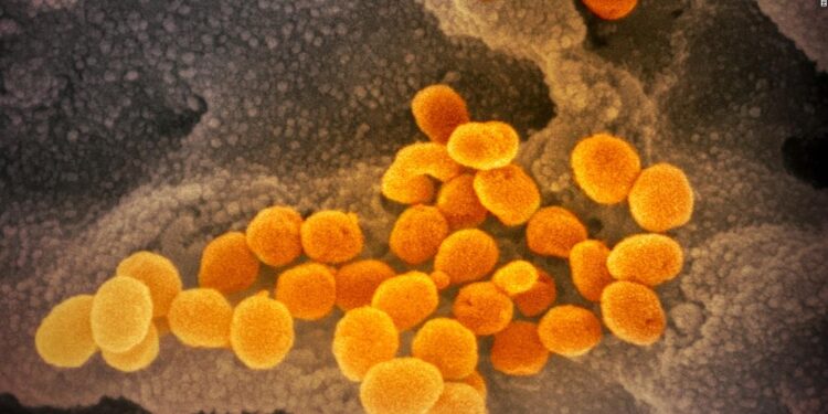 Live updates on the coronavirus pandemic